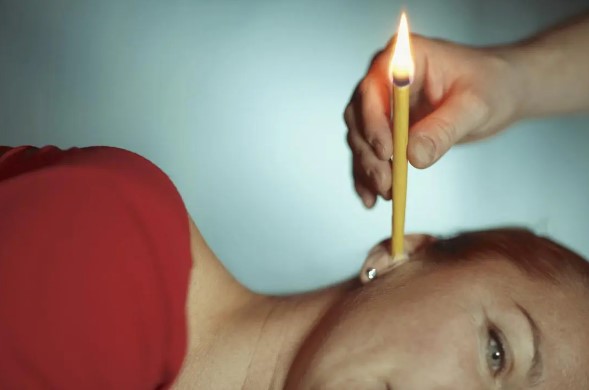 A Brief Overview of Ear Candling
