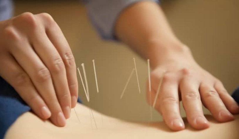 Is dry needling safe?