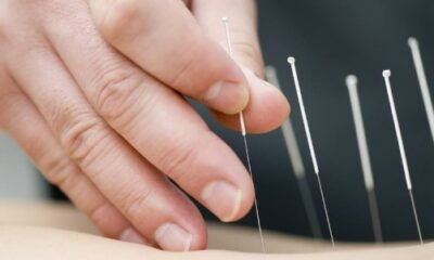 Pros and Cons of Dry Needling